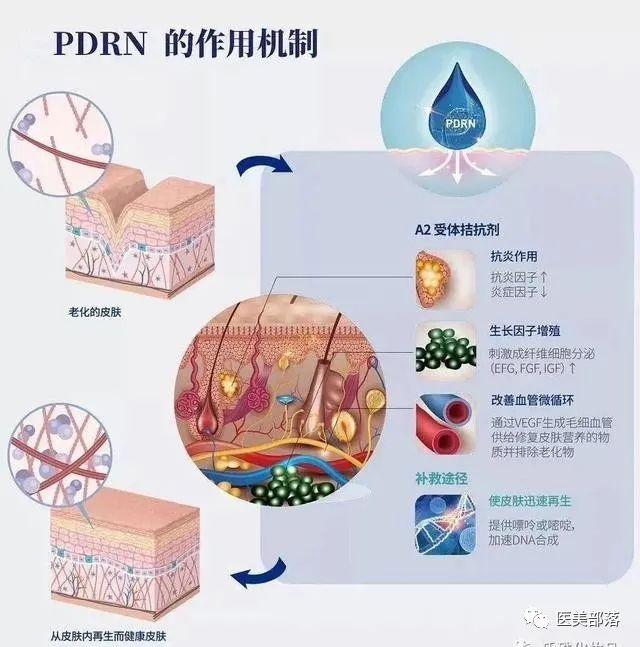 三文鱼针：关于"三文鱼针"中的PDRN和PN