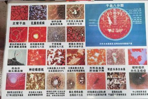 中山卫健局："内衣店"做医美，无证行医"七十二变"