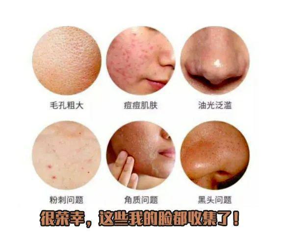科普：「果酸焕肤」新手刷酸指南