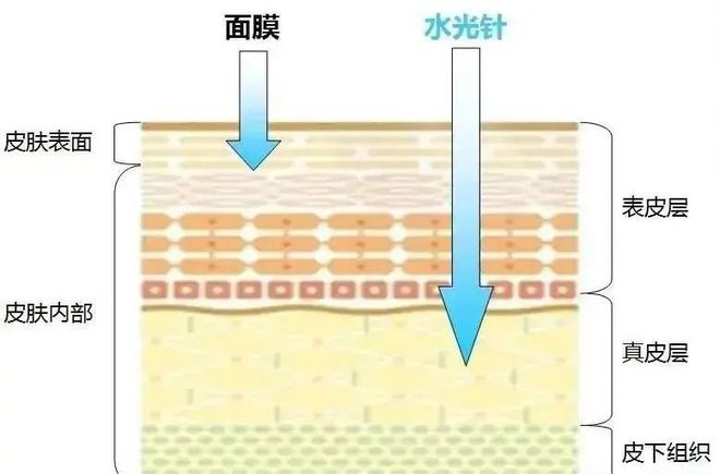 科普：「水光针」实用版使用攻略