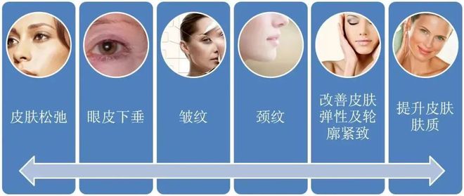 科普：「热玛吉」 抗衰首选干货指南