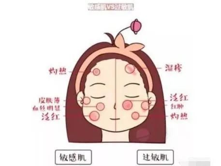 科普 ：拯救冬日「危肌」告别“干干干