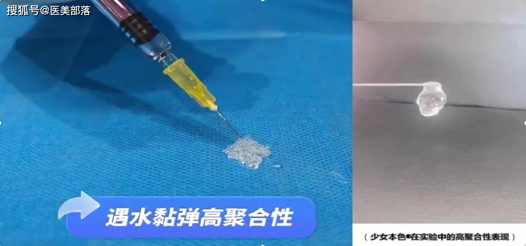 少女本色：新释「线性弹力」玻尿酸，引领美学新风尚