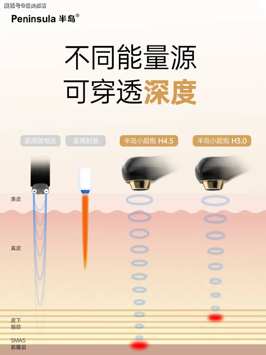 半岛小超炮：超声抗衰新时代，全新一代「家用超声美容仪」来了 