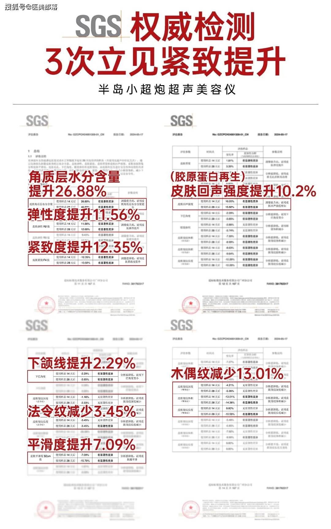 半岛小超炮：超声抗衰新时代，全新一代「家用超声美容仪」来了 