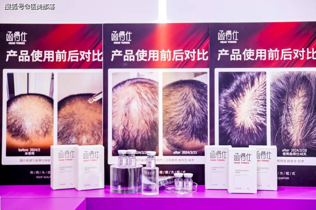 函得仕：「头皮健康」方程式，引领「洗护发4.0」时代 