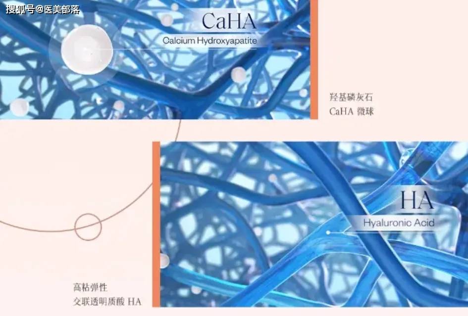 艾尔建美学 | 全球首个「液体线雕」HArmonyCa完成国内注册检验