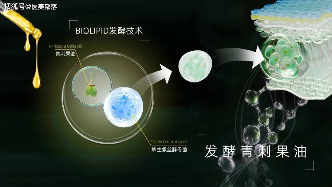 贝泰妮 | 旗下祛痘品牌「贝芙汀」，开创「分级祛痘」新时代 
