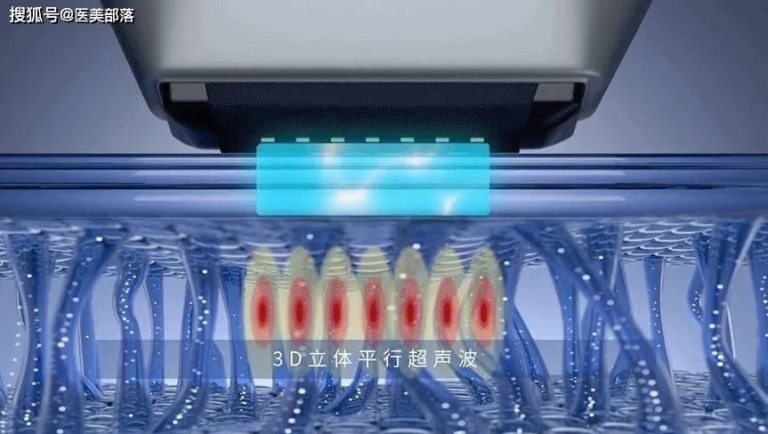 素芙波 | 首创「3D立体超声」技术，迎来「科技抗衰」全能王