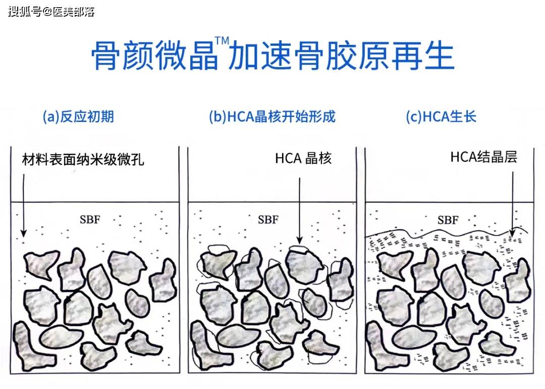 重磅 | 「骨颜微晶™」全新升级上市，「生物活性再生材料」再续抗衰新篇章