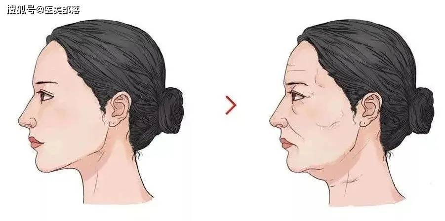 科笛集团 | 旗下「双下巴」溶脂针「CU-20401」完成II期临床试验
