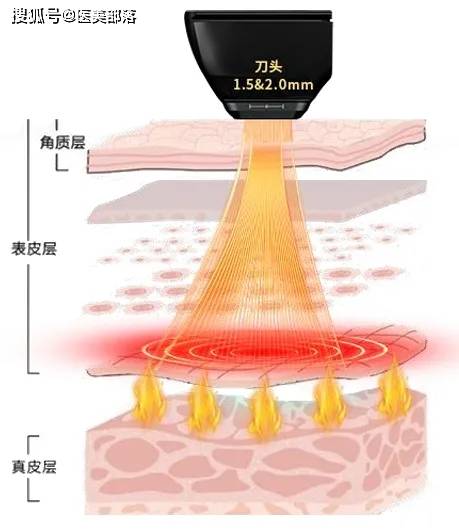 寻美之旅 | 全方位鉴赏「净妍生物」魅力，美拉美超声刀引领「多层抗衰」新风尚
