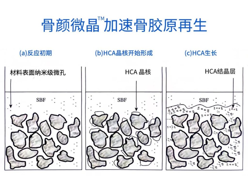 重磅 | 「骨颜微晶™」全新升级上市，「生物活性再生材料」再续抗衰新篇章