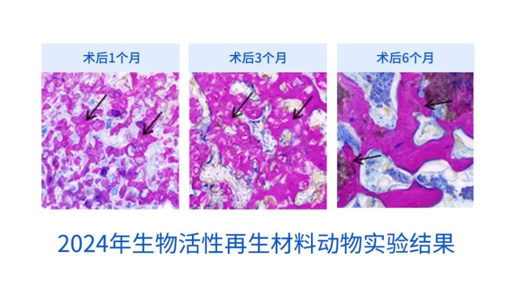 重磅 | 「骨颜微晶™」全新升级上市，「生物活性再生材料」再续抗衰新篇章