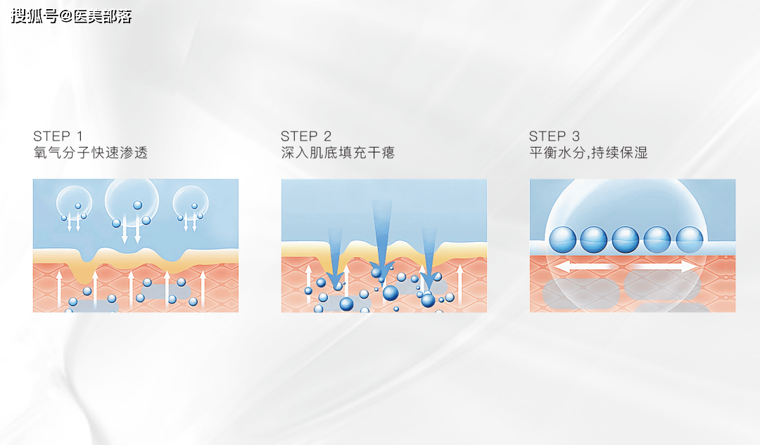 金达威医疗 | 聚舒美「舒敏治疗仪」与聚耀美「四色光谱治疗仪」双新品重磅发布