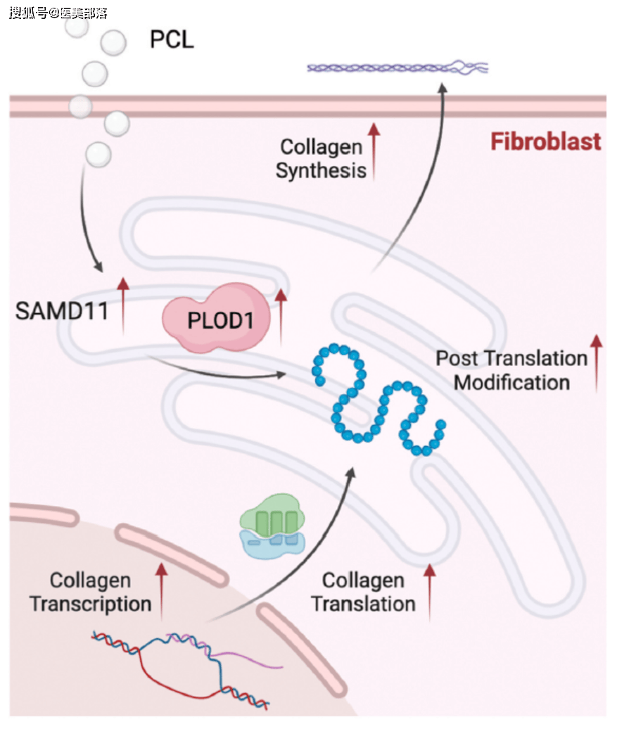 益诚生物 | 助力揭秘「PCL微球」促进「胶原再生」新机制