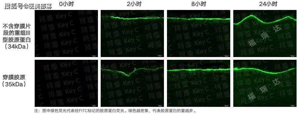 寻美之旅 | 聚焦福瑞达旗下「首个医美品牌」，「珂谧KeyC」科技美塑年轻化 