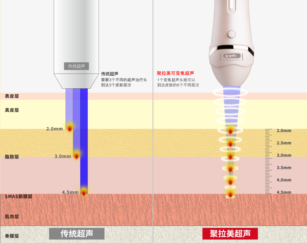 寻美之旅 | 科技智造，未来之美，「金达威」跨入医美器械新赛道