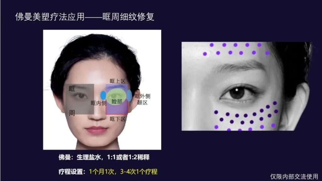 斐缦生物 | 二类「佛曼」严重侵权，认准三类「弗缦®」胶原蛋白