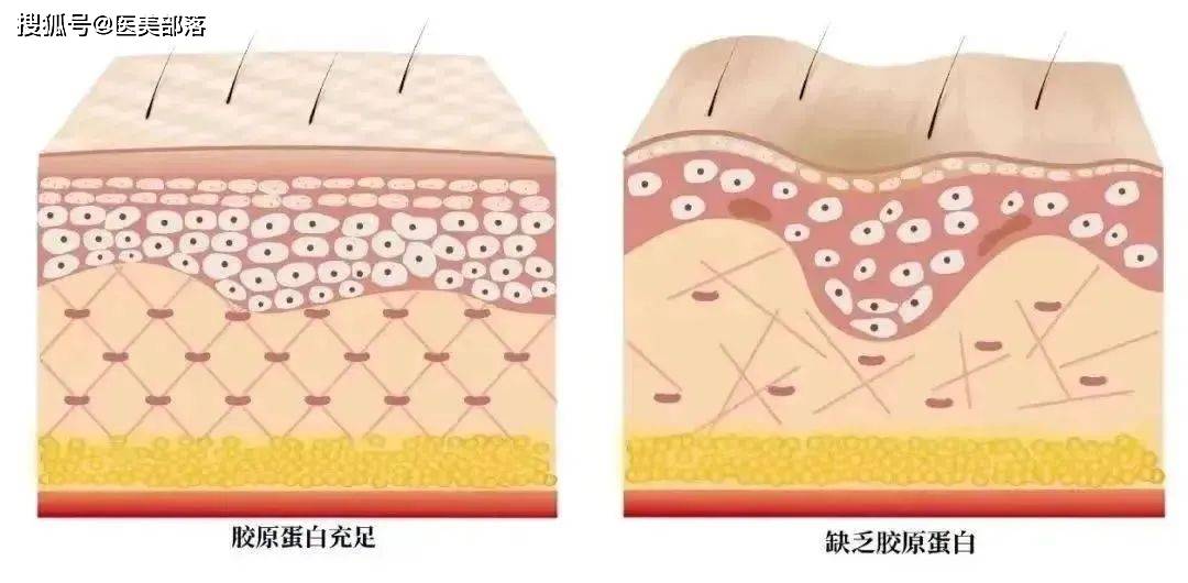 寻美之旅 | 「光原昕生」用科技定义美，以「重组胶原蛋白」打造医美行业新标杆