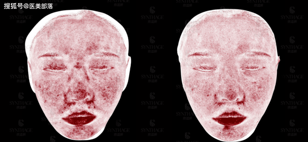 乐伊美生物 | 院线级爆品组合「胶原三次方」，打造医美机构「抗衰首选」
