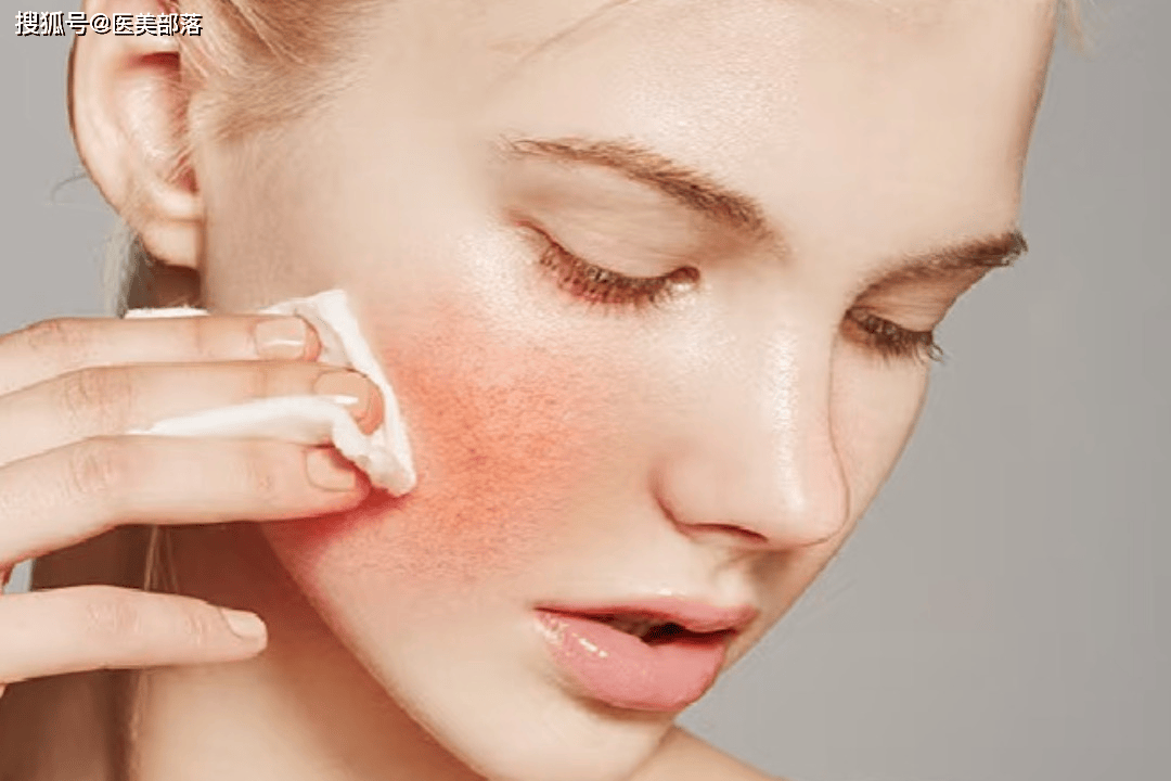 重磅 | 别让疼痛劝退您的求美者，「金蔓佳」助力解锁国庆「舒适焕肤」之旅