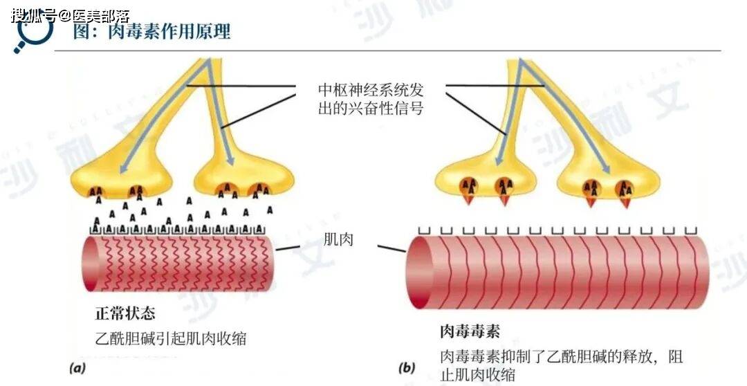 沙利文 | 发布「2025医美注射类产品」行业发展现状与未来趋势蓝皮书